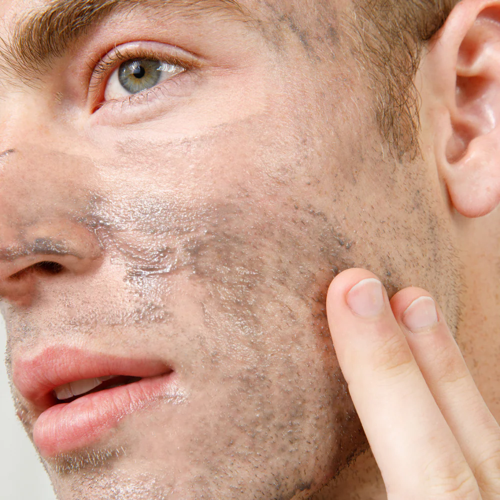 Exfoliante Facial de Carbón Detox