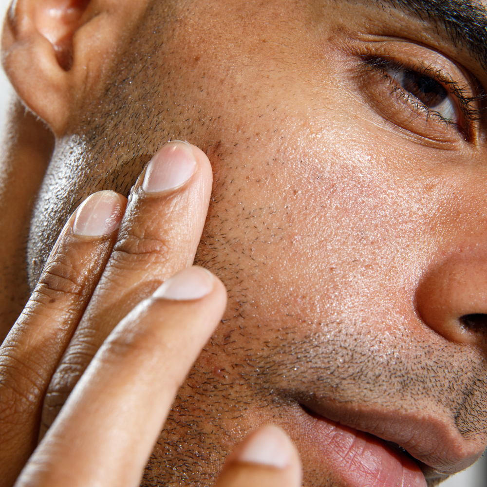 Close-up of man applying skincare cream on smooth, glowing dark skin with visible stubble and clear complexion.